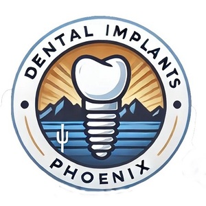 Dental Implants Phoenix - Phoenix, AZ, USA